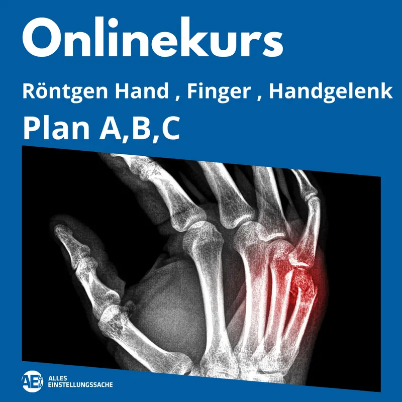Videokurs Einstelltechnik Hand, Finger Handgelenk