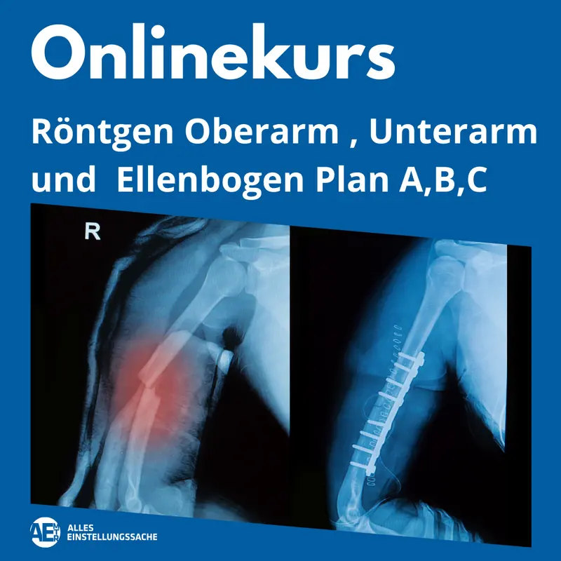 Videokurse Einstelltechnik